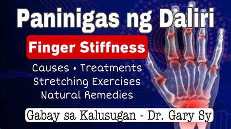 Finger Stiffness: Causes, Treatments, Self-Help & Natural Remedies - Dr ...