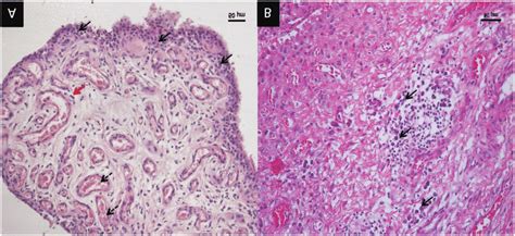 Histopathology of the OA lesioned synovium. (A) Synovium with ...