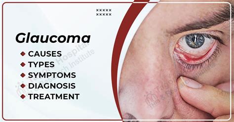 Glaucoma Diagnosis