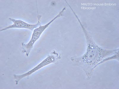 Fibroblast | Definition, Histology, & Function | Britannica