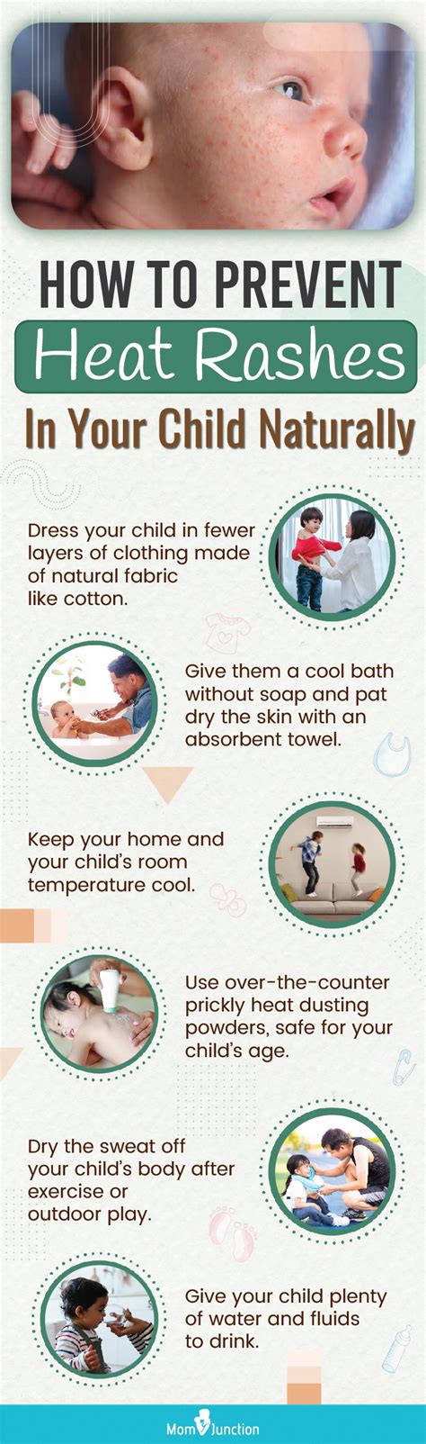 Heat Rashes In Children: How To Treat And Prevent Them