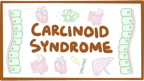 Carcinoid syndrome: Video, Causes, & Meaning | Osmosis