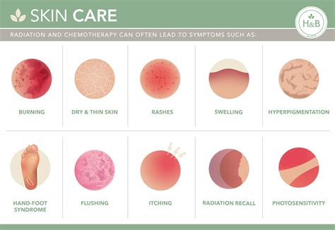 Skin Cancer Types Chart