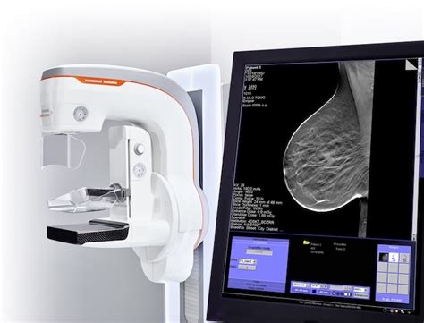 3D Breast Tomosynthesis ROI Calculator | Cassling