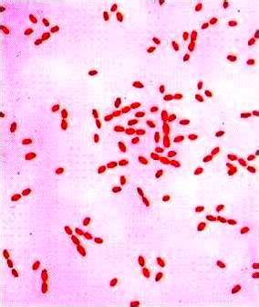 Brucella and Brucellosis | Medchrome