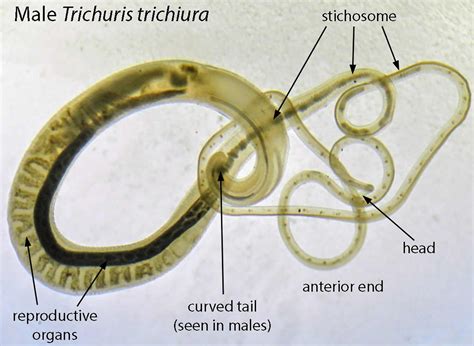 Whipworm in humans symptoms, prevention, diagnosis & whipworm treatment