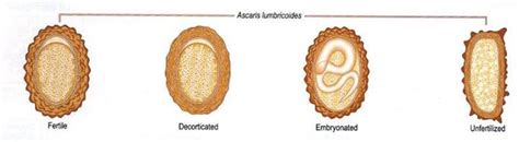 Ascaris lumbricoides: Morphology, life cycle, Pathogenesis, lab ...