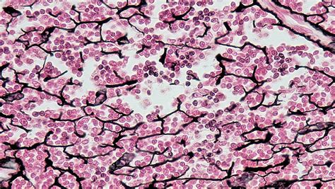 Difference Between Connective Tissue Proper and Specialized Connective ...