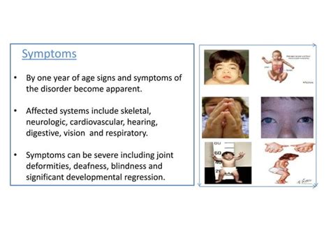 Mucopolysaccharidosis | PPT