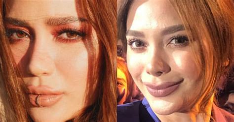 Arci Muñoz had a nose job? See before and after photos! | MyKiRu IsYuSeRo