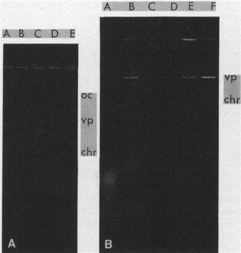 Fig. la. Cell lysates of five multiresistant S. dublin isolates run ...