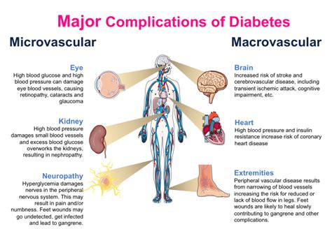 PDB-101: Global Health: Diabetes Mellitus: Monitoring: Complications