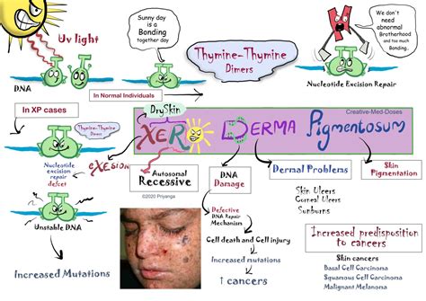 Xeroderma Pigmentosum: The moon child - Creative Med Doses