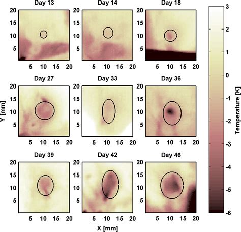 Thermographic investigation of tumor size, and its correlation to tumor ...