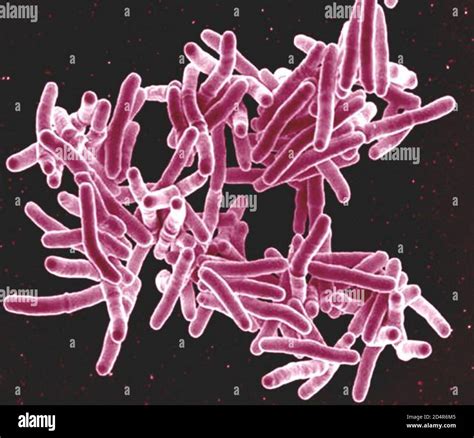 Mycobacterium tuberculosis Bacteria, the Cause of TB Scanning electron ...