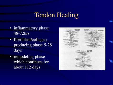 PPT - FLEXOR TENDON INJURIES James M. Steinberg D.O. Garden City ...