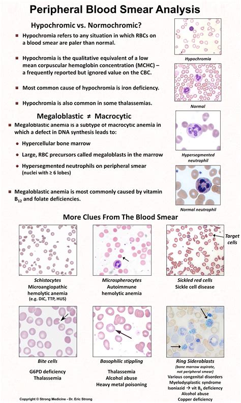 Blood Smear Cheat Sheet