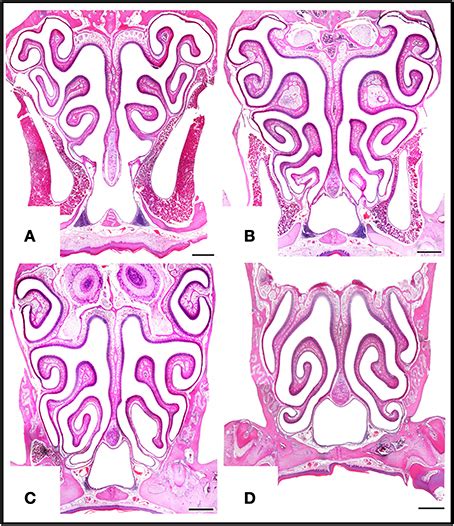 Nasal Turbinate Histology