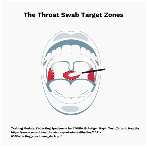 how to throat swab? : r/COVID19positive