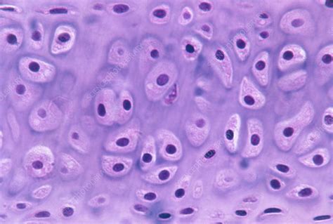 LM of a section through hyaline cartilage - Stock Image - P174/0027 ...