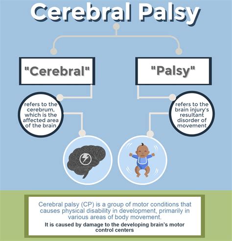 About Cerebral Palsy | Michigan Cerebral Palsy Attorneys