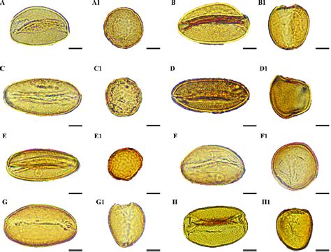 Light microscope micrographs of pollen grains of eight species of Gagea ...