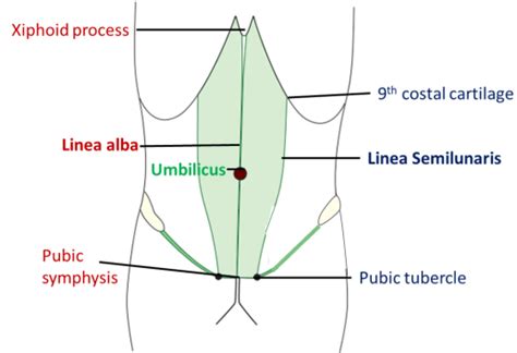 Anterior Abdominal Wall , layers, umbilicus, muscles, blood supply and ...