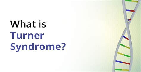 Turner Syndrome Karyotype