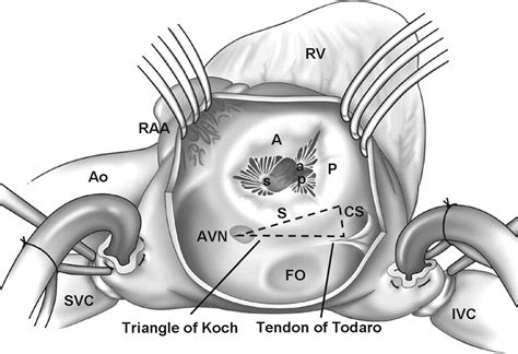 Tricuspid Valve