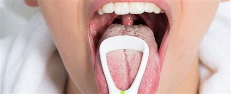 What Bacteria Lives In A Human Mouth? | AP Smilecare | Blackburn