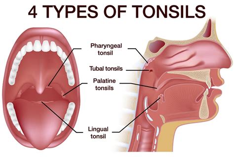 Tonsil | Studio Dentaire