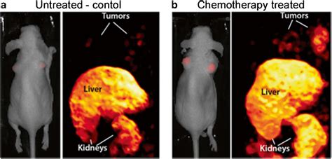 Figure 1 from The role of radionuclide probes for monitoring anti-tumor ...