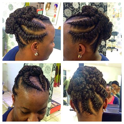 Alopecia. After Braids. | Hair styles, Alopecia, Hair