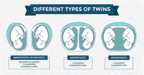 TYPES OF TWINS – Dr.V.GEETHA