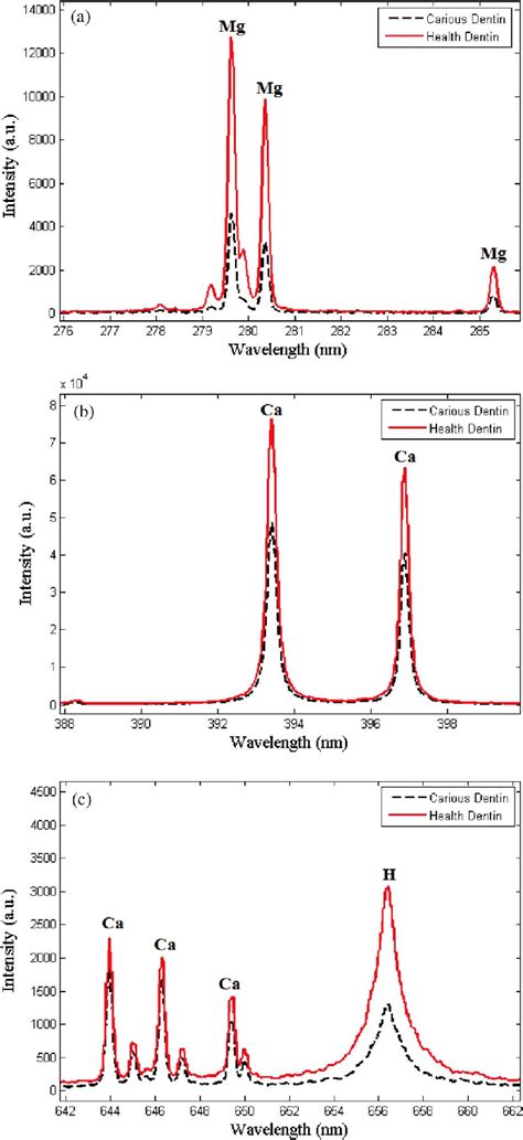 Comparison of some important emission lines between healthy (solid ...