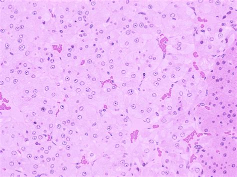 Chromaffin Cells Histology