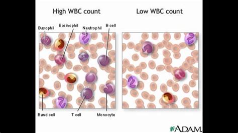 White Blood Cell Count Levels Chart