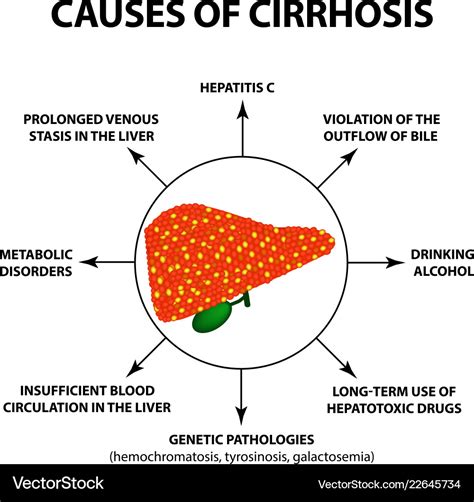 What Is Cirrhosis Causes And Treatment Health Times | Images and Photos ...