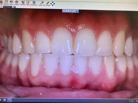 SAN MARCOS ORTHODONTICS - Updated May 2024 - 160 Photos & 135 Reviews ...