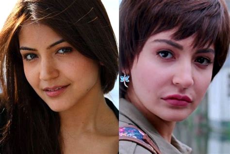 Anushka Sharma Plastic Surgery Before And After - sekho.in