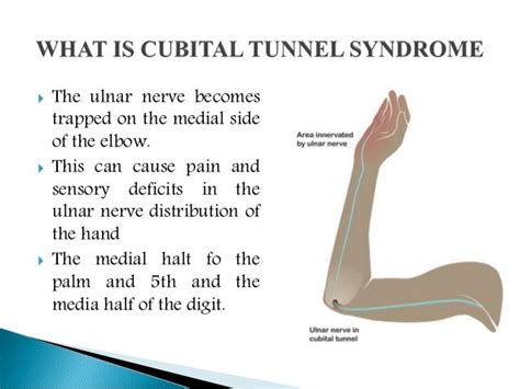 Cubital tunnel syndrome: Causes, symptoms, diagnosis and treatment