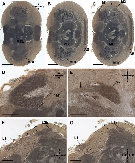 General anatomy of visual neuropils and protocerebrum in Amblypygi ...