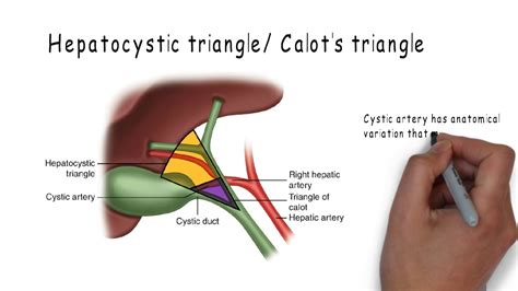 Calot's Triangle: Surgery - YouTube