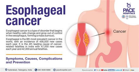 Esophageal Cancer - Symptoms, Causes, Complications & Prevention