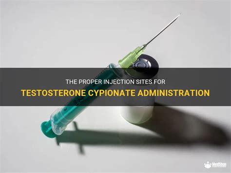 The Proper Injection Sites For Testosterone Cypionate Administration ...