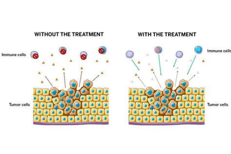 New Cancer Treatment Uses Enzymes to Boost Immune System and Fight Back ...