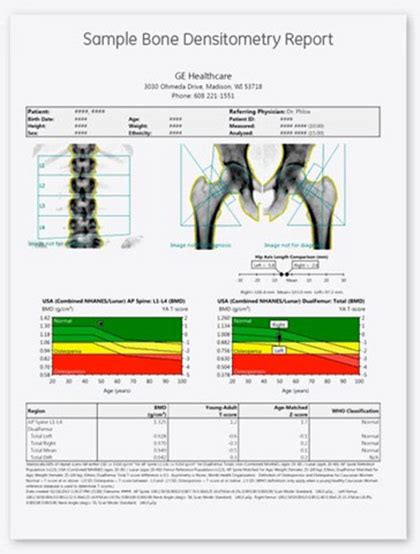 DXA Results Interpretation: Continuing Education for X-ray Techs