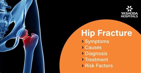 Hip Fracture: Types, Symptoms, Causes, Risk Factors, Diagnosis and ...