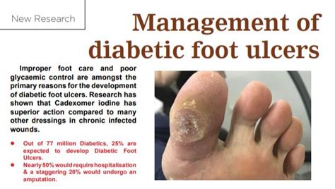 Diabetic Foot Ulcer Amputation