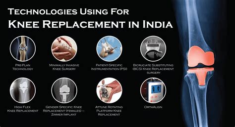 Minimally Invasive Total Knee Replacement Surgery